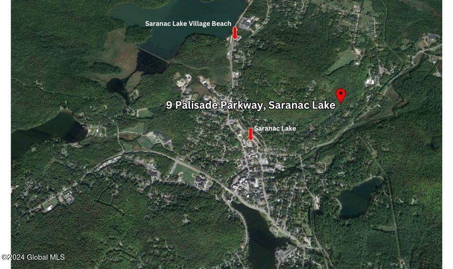 Residential in Saranac Lake 5