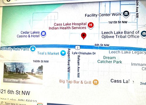 421 6th St Nw, Cass Lake, MN, 56633 | Card Image