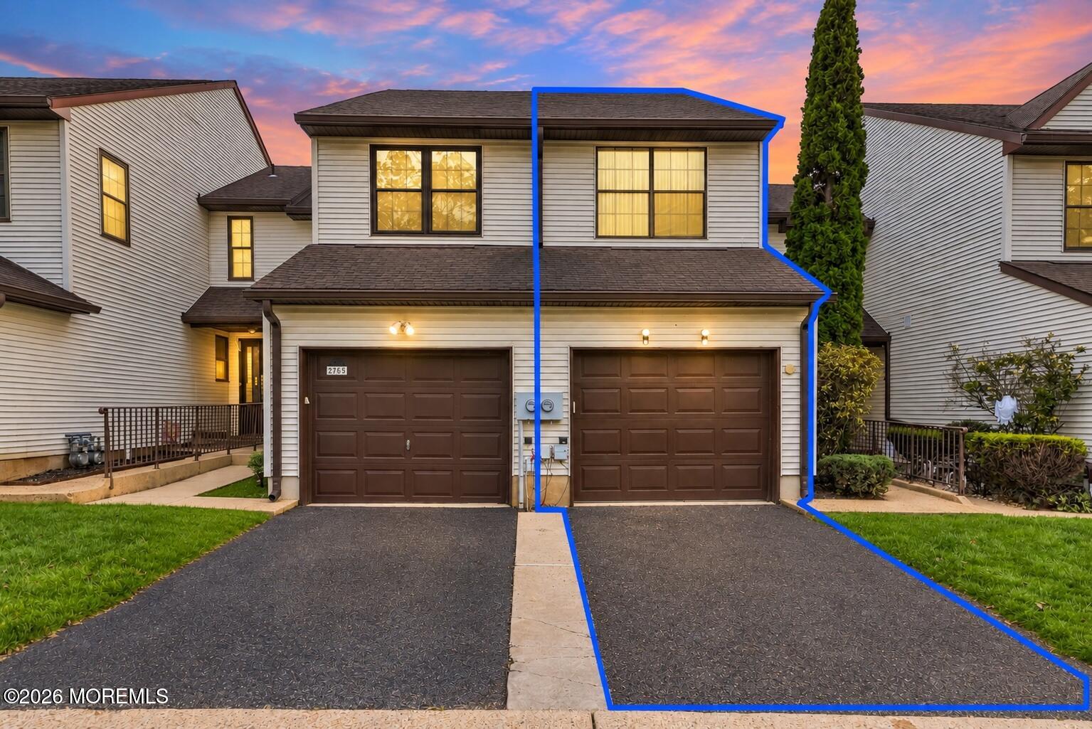 Residential Lease in Manalapan 4